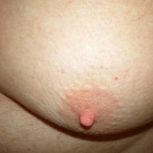 My nipple.