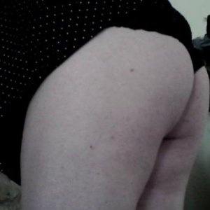 Butt after one year on HRT